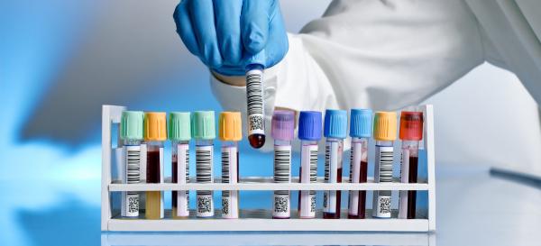 CHECK-UP ROUTINE MINIMO