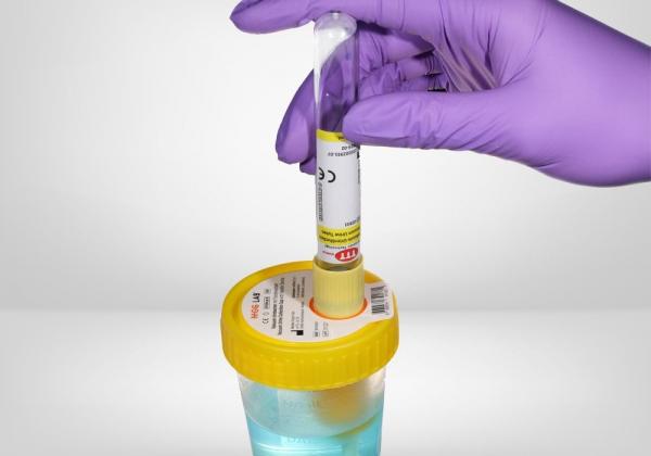 Indicazioni Raccolta URINE
